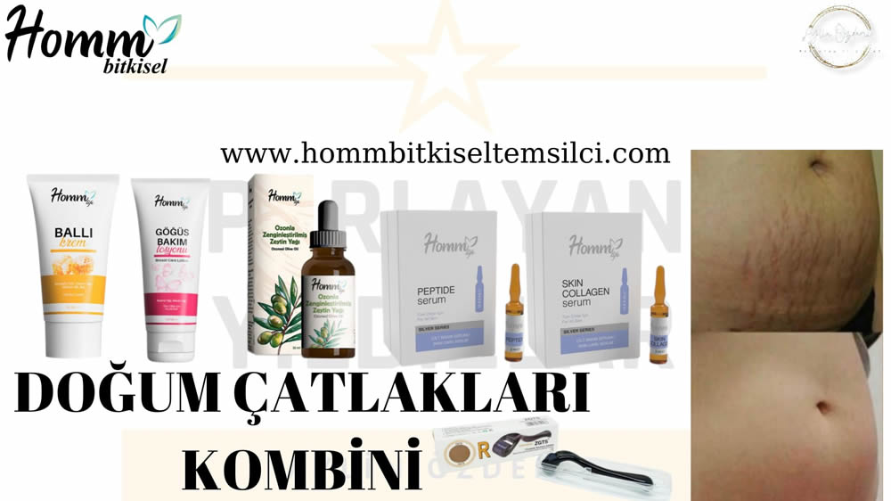 DOĞUM ÇATLAKLARI KOMBİNİ